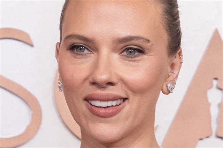 Scarlett Johansson's Plastic Surgery Journey Revealed